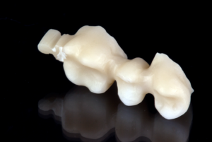 ESTRUCTURA EN ZIRCONIA CAD-CAM